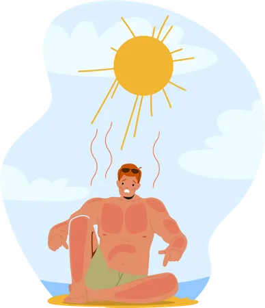 Homme grimaçant de douleur suite à un coup de soleil sur la plage  Illustration