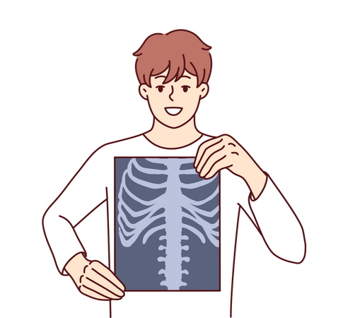 Homme, poumons, radiographie  Illustration