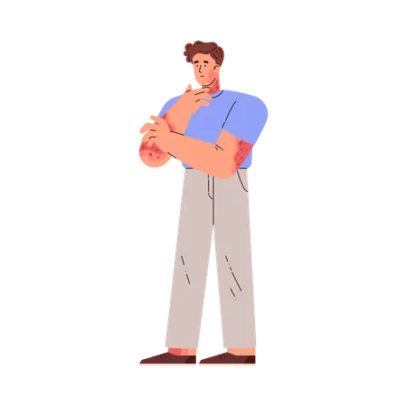 Un homme souffrant se gratte la peau de la main  Illustration
