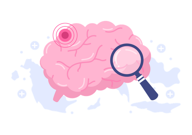 Hypertension Stroke  Illustration