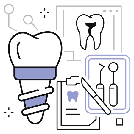 Implant dentaire  Illustration