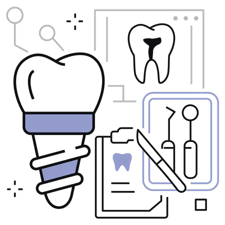 Implante dental  Ilustración