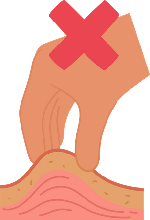 Incorrect Skin Fold For Potentially Causing Pain  Illustration