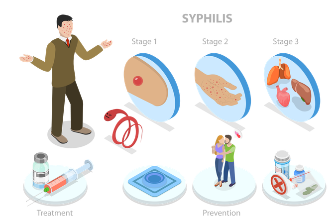 Infection sexuellement transmissible  Illustration