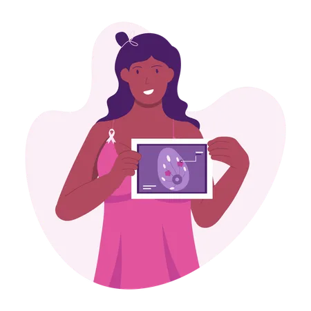 Informe sobre el cáncer de mama  Ilustración