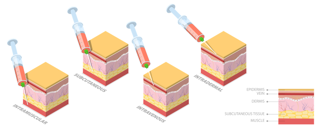 Injection Types  Illustration