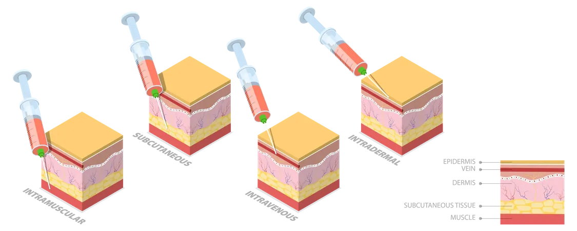 3 D Isometric Flat Vector Conceptual Illustration Of Injection Types Different Techniques Of Safe Injections Illustration