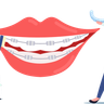 dental braces illustration