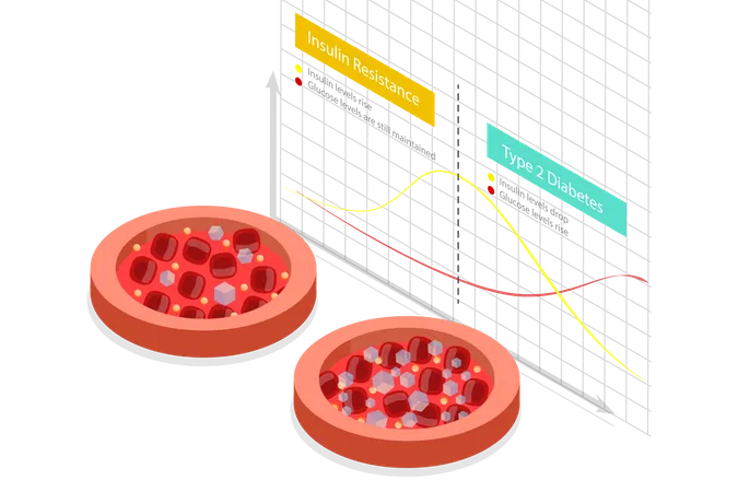 Insulin resistance and Type 2 diabetes chart  Illustration