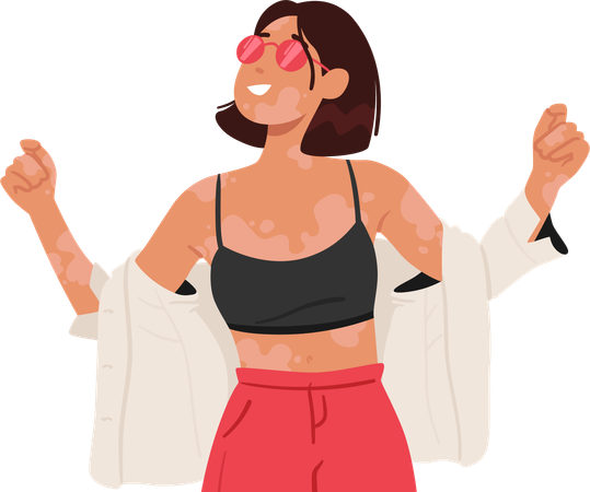 Joyful Girl with vitiligo  Illustration