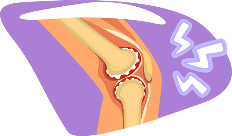Knee pain Illustration