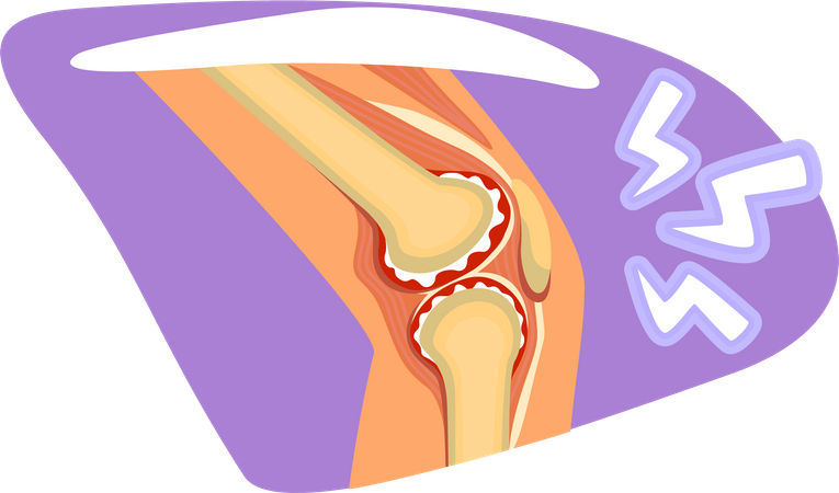 Knee pain  Illustration