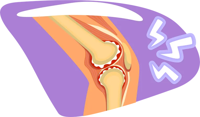 Knee pain  Illustration