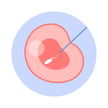 In Vitro Befruchtungskonzept Kunstliche Befruchtung Der Eizelle Einer Frau Im Labor Weibliche Eizelle Und Mannliches Sperma Mikroskopische Ansicht Vektorillustration Illustration