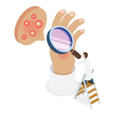 La dermatite atopique  Illustration