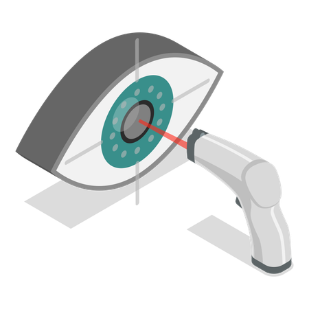 Lasik-Operation  Illustration