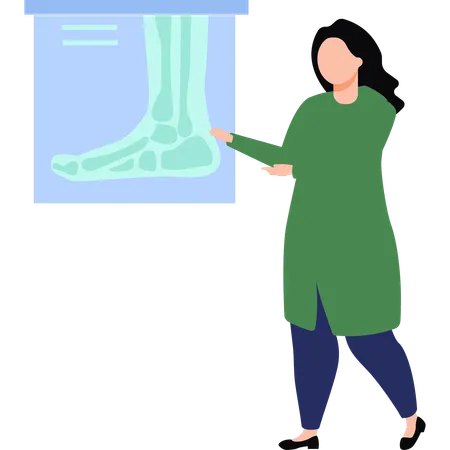 Le médecin montre la radiographie du pied  Illustration