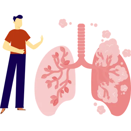 Un homme a des problèmes pulmonaires  Illustration