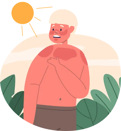 Uncomfortable And Red Little Boy Character With Painful Sunburn Seeking Relief And In Need Of Soothing Remedies For His Damaged Skin Kid On The Beach Cartoon People Vector Illustration Illustration