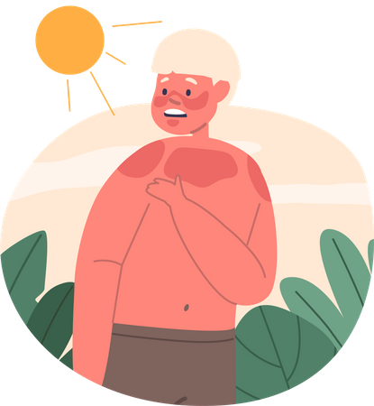 Little boy with painful sunburn  Illustration