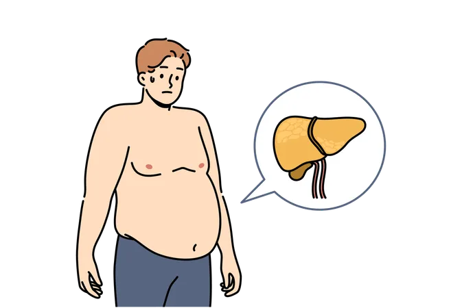 Liver Illnesses In Men Cause Obesity And Digestive Problems And Symptoms Of Fatty Hepatosis Yellow Liver Near Guy Suffering From Jaundice Caused By Poor Hygiene Or Weakened Immune System Illustration
