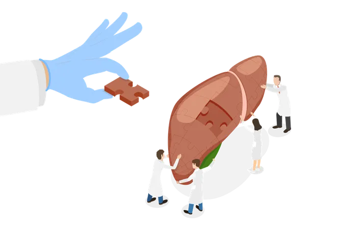 Liver Transplantation  Illustration