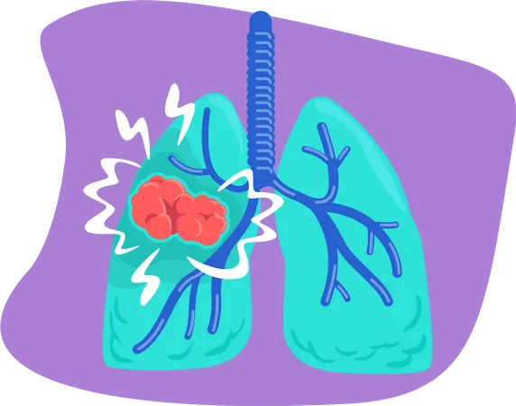 Lung cancer  イラスト