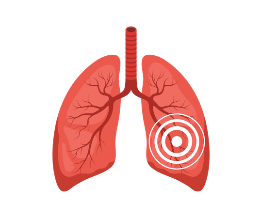 Lungenschmerzen. Menschliche innere Organerkrankung. Medizinische Diagnose und Behandlung der Lunge. Vektorillustration im flachen Cartoon-Stil  Illustration
