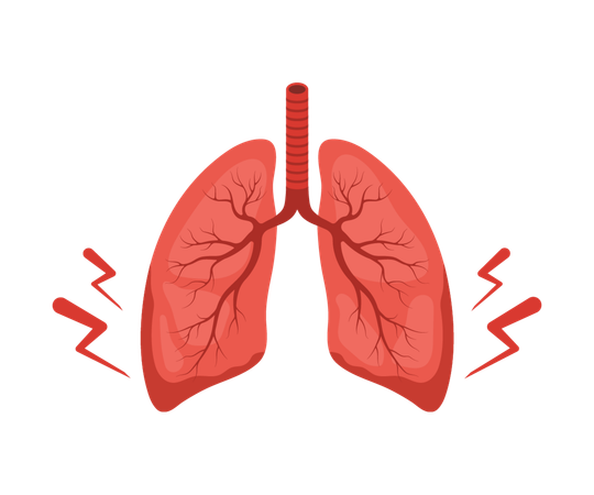 Lungs pain. Human internal organ disease. Lungs medical diagnosis and treatment. Vector illustration in flat cartoon style  Illustration