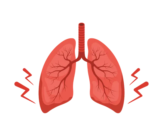 Lungs pain. Human internal organ disease. Lungs medical diagnosis and treatment. Vector illustration in flat cartoon style  Illustration