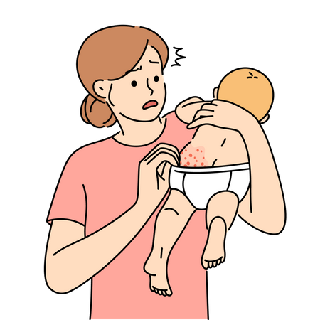 Mãe vê assaduras no bebê devido à fralda  Ilustração