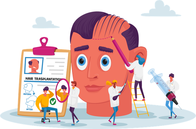 Male Head Making Hair Transplantation Procedure  Illustration
