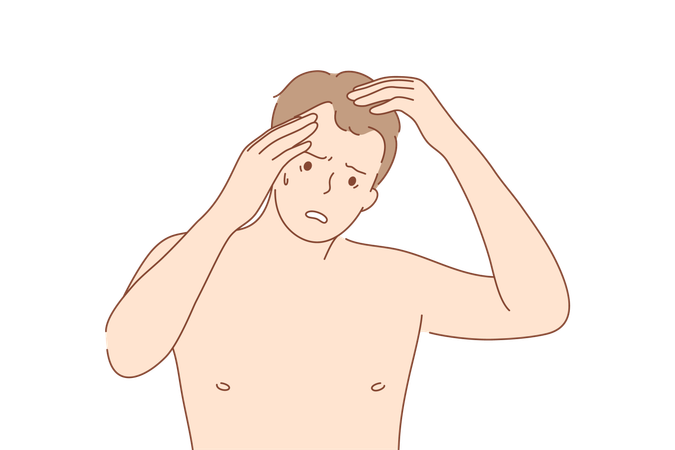 Male pattern baldness  Illustration