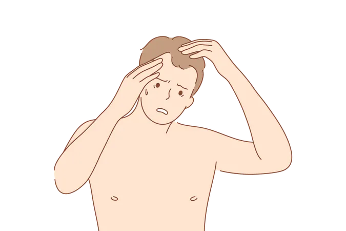 Male pattern baldness  Illustration