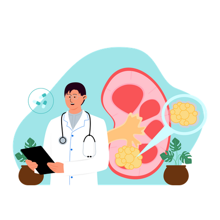 Male surgeon check kidney stone report  Illustration