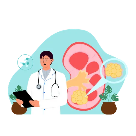 Male surgeon check kidney stone report  Illustration