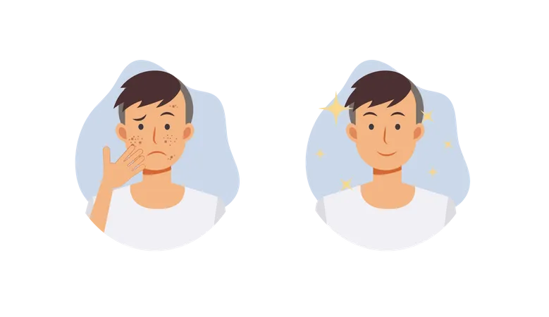 Skin Care Concept Before And After Acne Treatment Procedure A Man With Acne Problem Flat Vector Cartoon Character Illustration Illustration