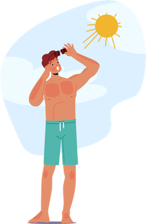 Man Experiences Painful Sunburn On The Beach  Illustration