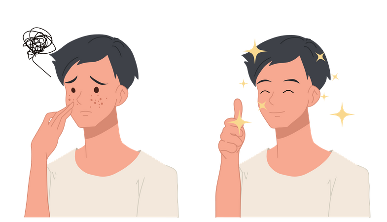 Man feeling happy after acne treatment  Illustration