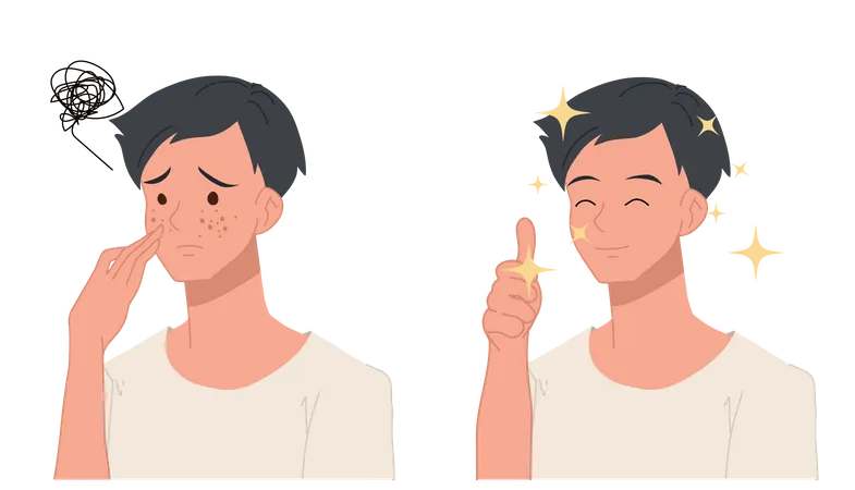 Man feeling happy after acne treatment  Illustration