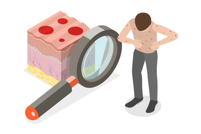 Man having Chickenpox  Illustration