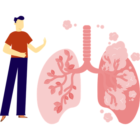 Man is having lungs problem Illustration