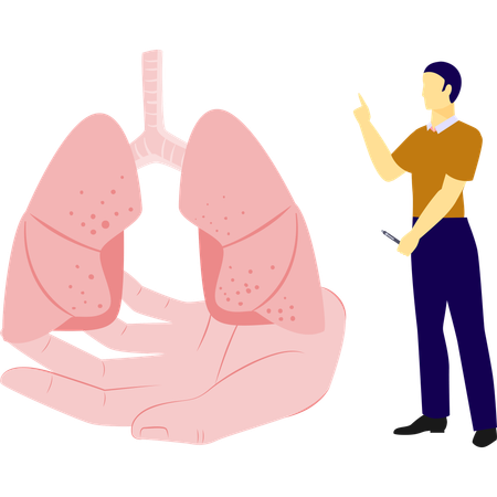 Man is telling about bronchus cancer  Illustration