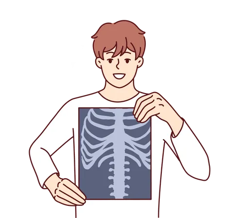 Man lungs xray  Illustration