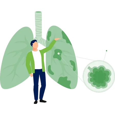 A Boy Is Pointing Lung Cancer Illustration