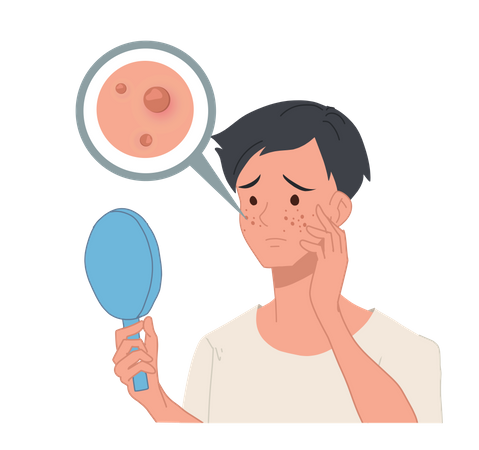 Man suffering from acne look into mirror  Illustration