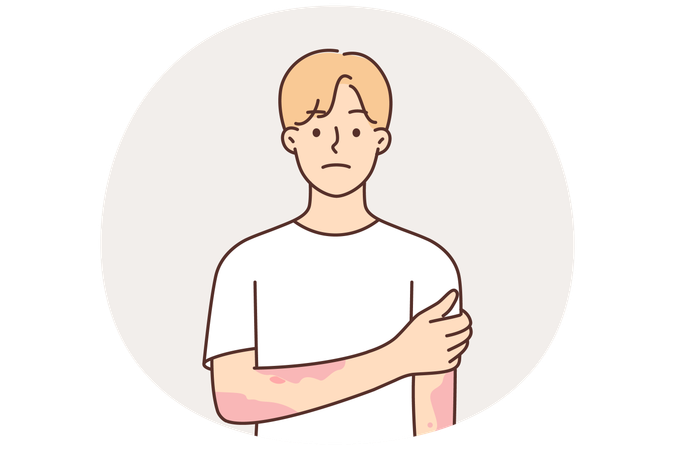 手に斑点がある皮膚炎や皮膚疾患に苦しむ男性は皮膚科医の助けを必要としている  イラスト