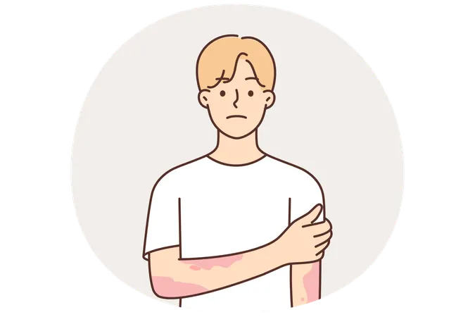 手に斑点がある皮膚炎や皮膚疾患に苦しむ男性は皮膚科医の助けを必要としている  イラスト