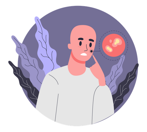 Man suffering from oral ulceration due to chemotherapy  Illustration