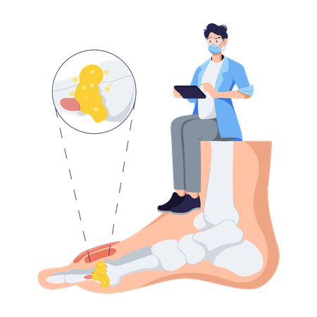 Man Suffers From Gout  Illustration